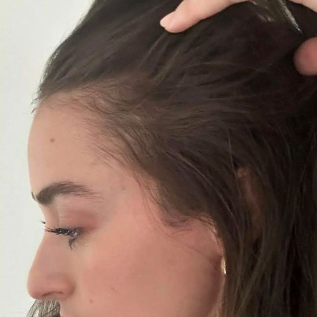 After consistent daily use of PrimeTallow Copper Peptide Supplement