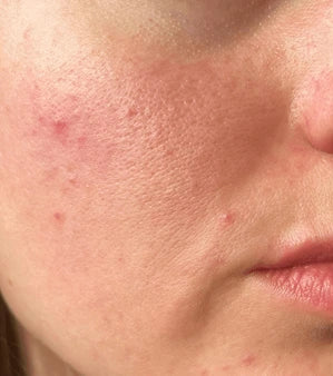 Before using PrimeTallow Skin Care Cream